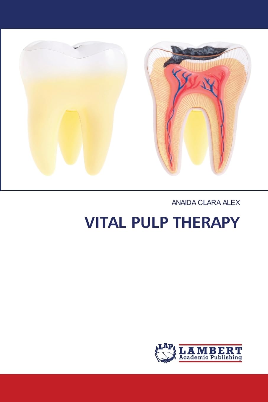 VITAL PULP THERAPY : ALEX, ANAIDA CLARA: Amazon.ie: Books